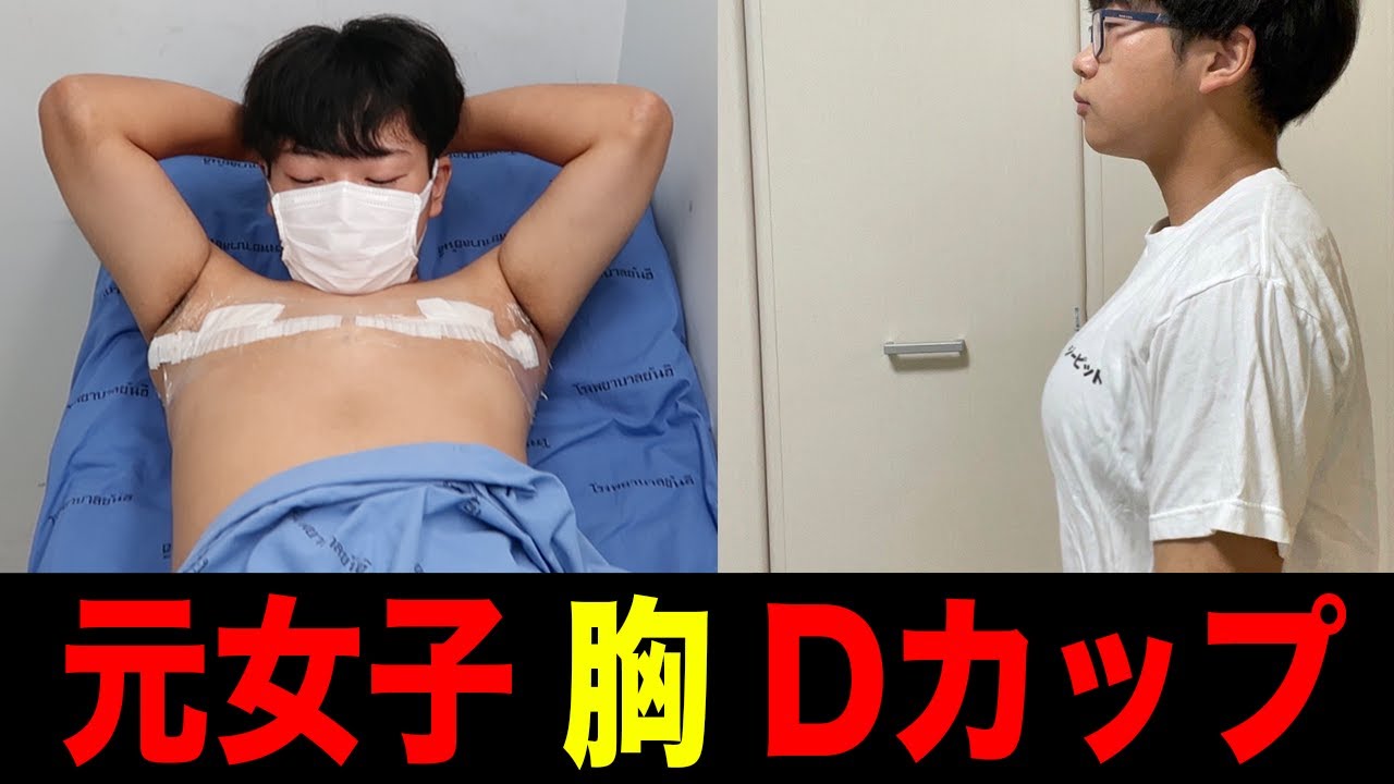 【密着】タイ性転換の裏側を密着取材しました。術前・手術・術後全部見せます！