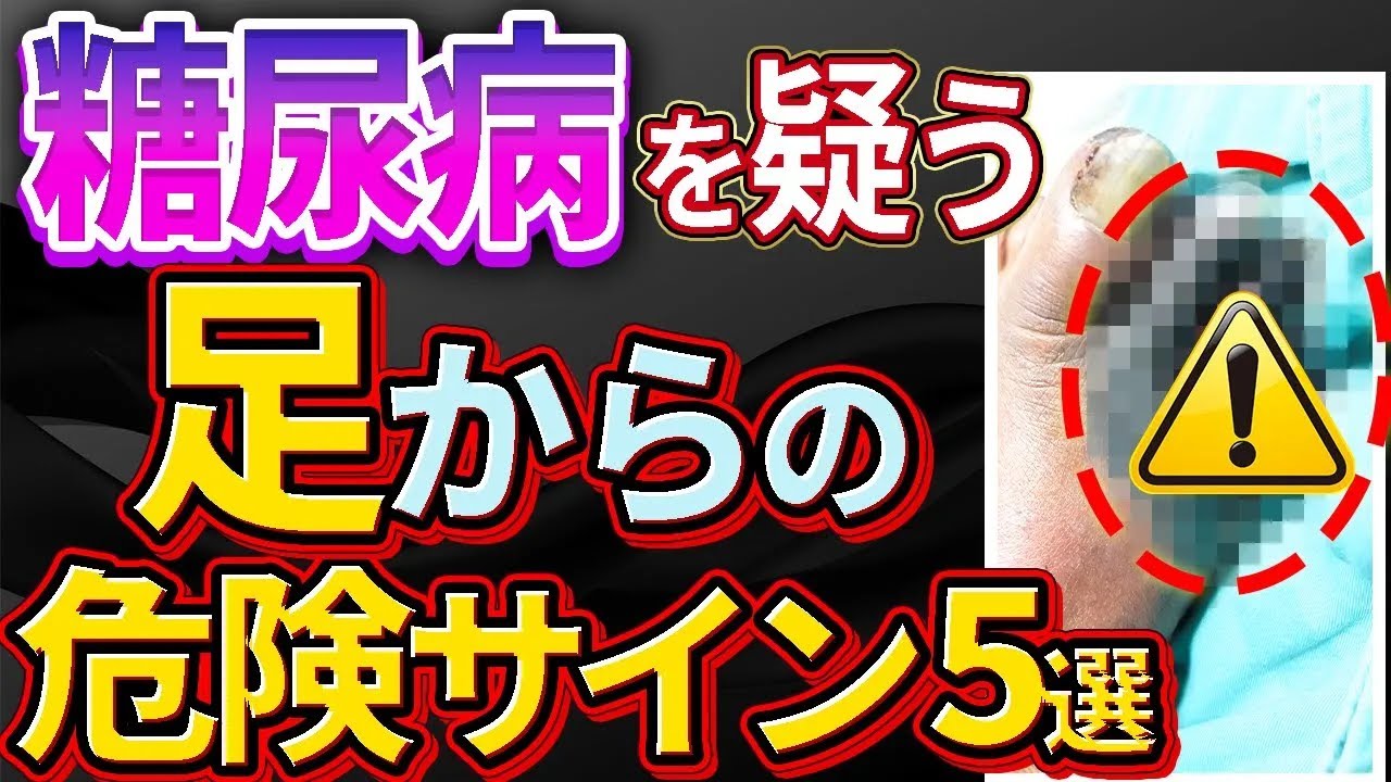 放置厳禁絶対見逃してはいけない糖尿病を疑う足の症状5選について解説します
