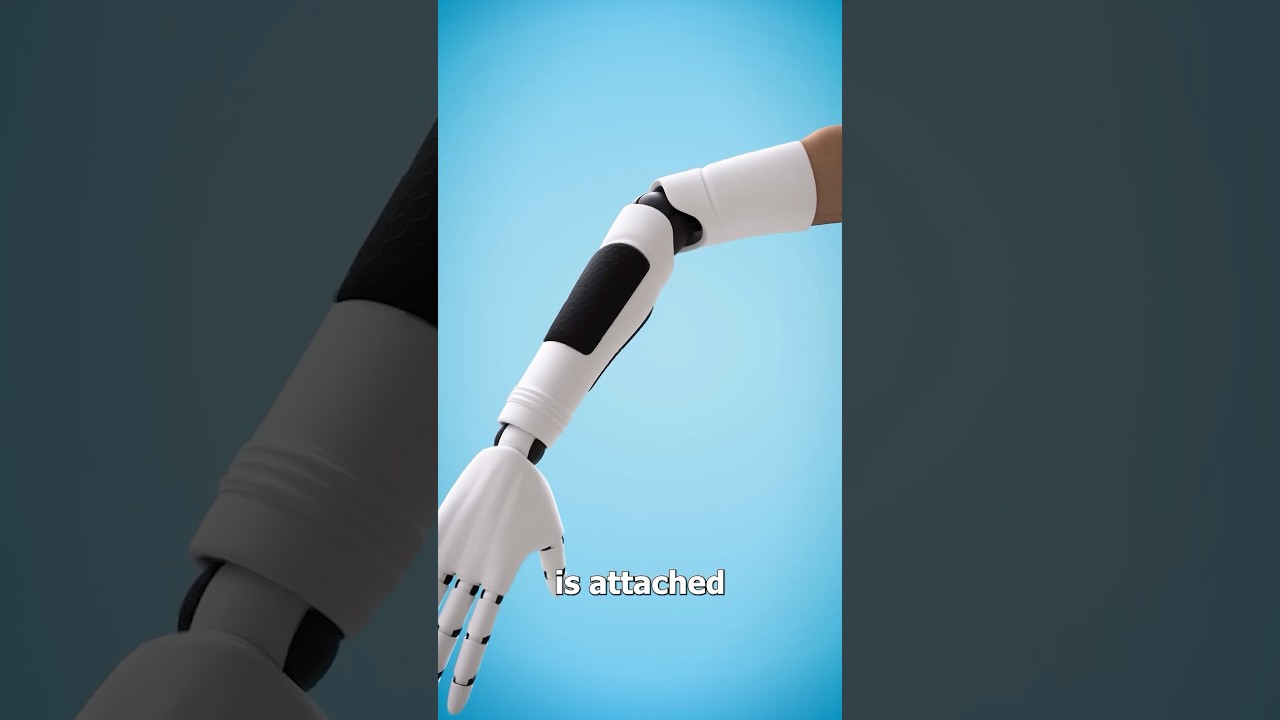 How A Bionic Arm Works 😲 Surgeon Reacts