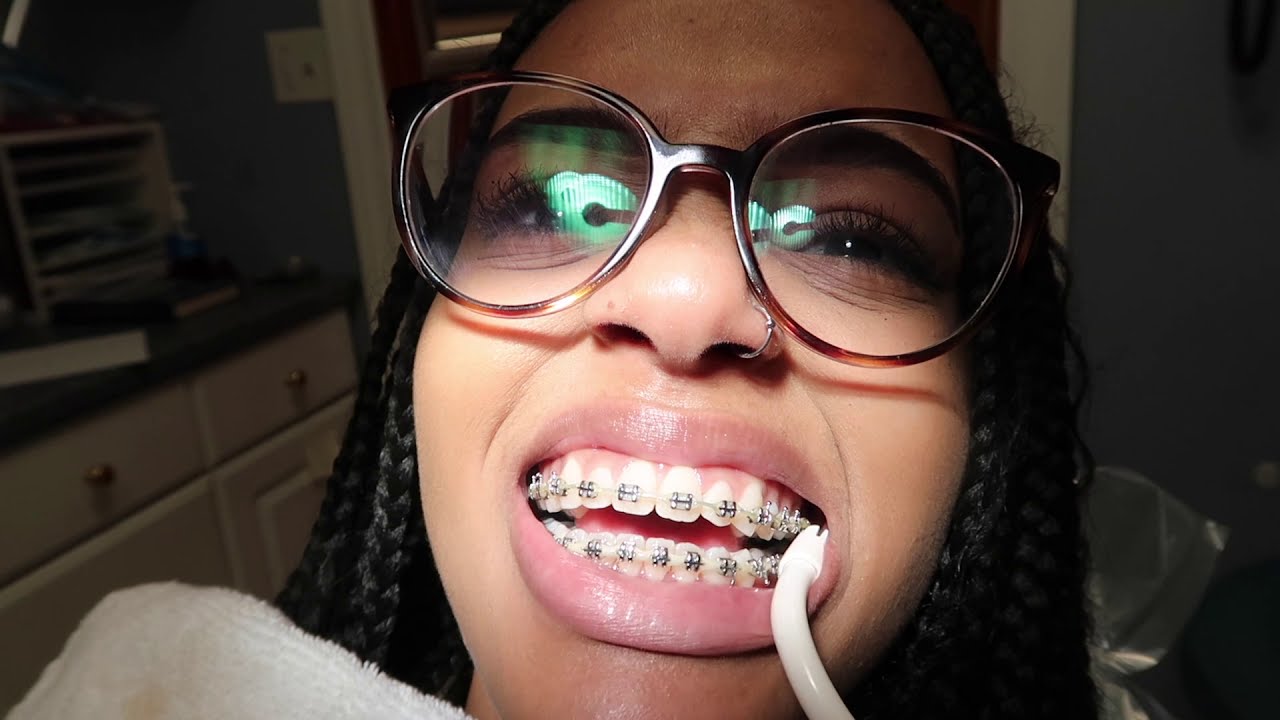 MOM WORKS ON MY TEETH!? (PAINFUL)CHICAGO VLOG(PT.2)