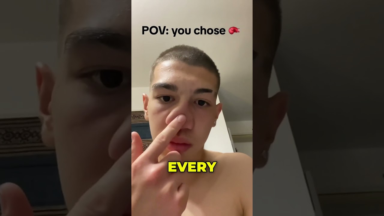 Why You Always Wear Headgear🥊 (@francescosabaa_)