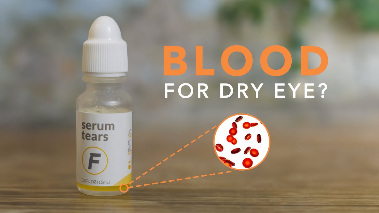 What are Serum Tears?