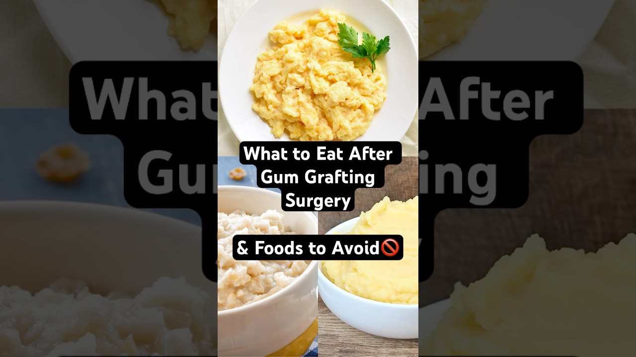 Just Had Gum Surgery? Here's What You CAN & CAN'T Eat!  |  District Dental Surgery