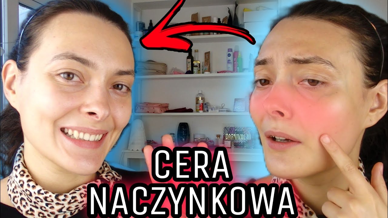 Przestałam się czerwienić! CERA NACZYNKOWA: jak dbać?
