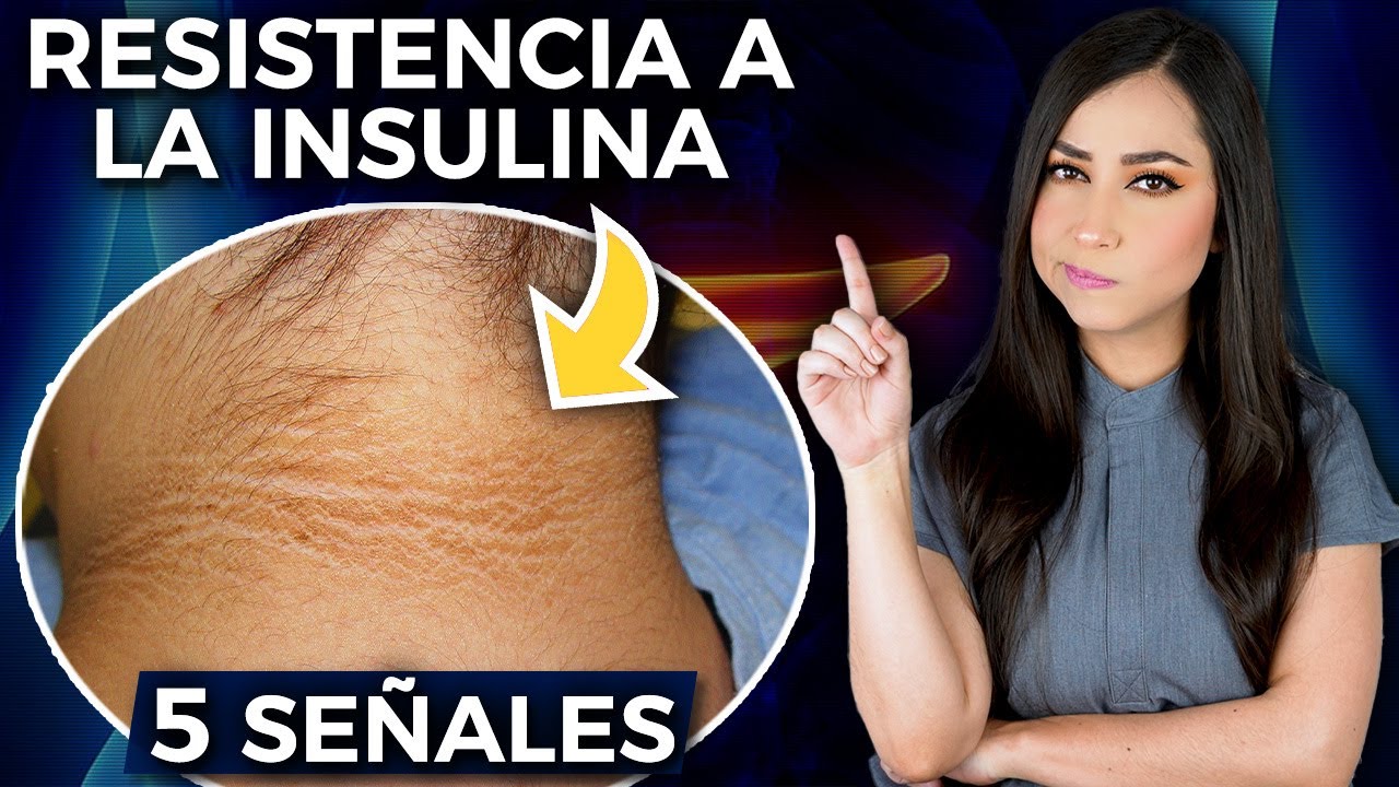 RESISTENCIA A LA INSULINA l Síntomas y ¿CÓMO REVERTIRLA? 👩🏻‍⚕️ @Dra. Pau Zúñiga