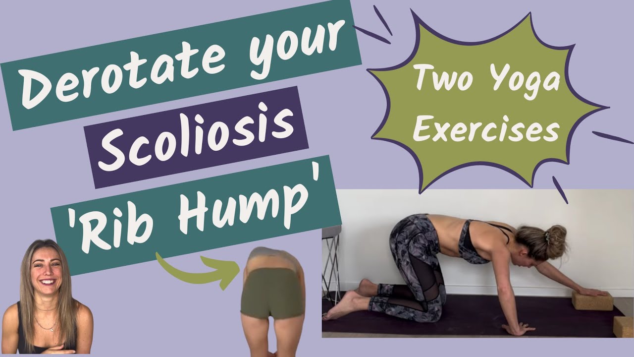 Derotate Your Scoliosis 'Rib Hump' - try these two yoga exercises