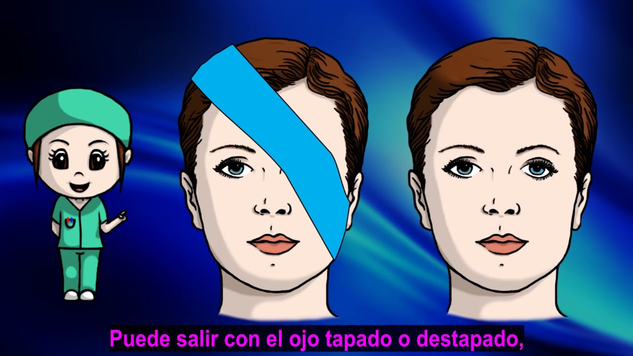 Cuidados de enfermería preparatorios en la cirugía ocular