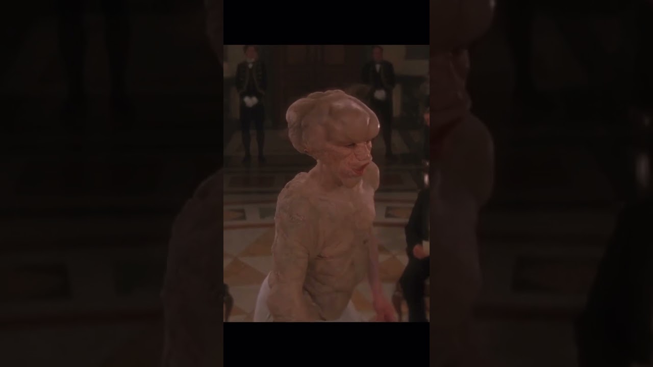 Человек-слон