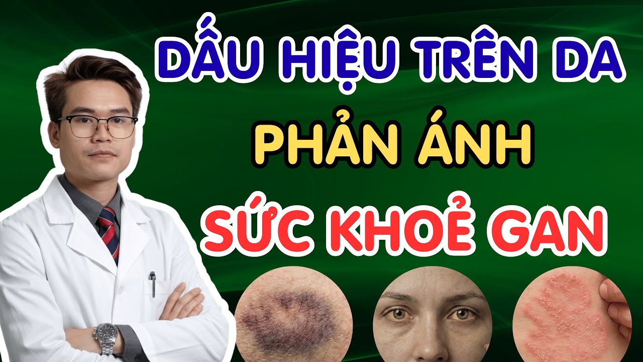 15 Dấu Hiệu Trên Da Cảnh Báo Gan Bạn Đang Gặp Vấn Đề (Có Cách Khắc Phục) | Bs Phạm Tuấn