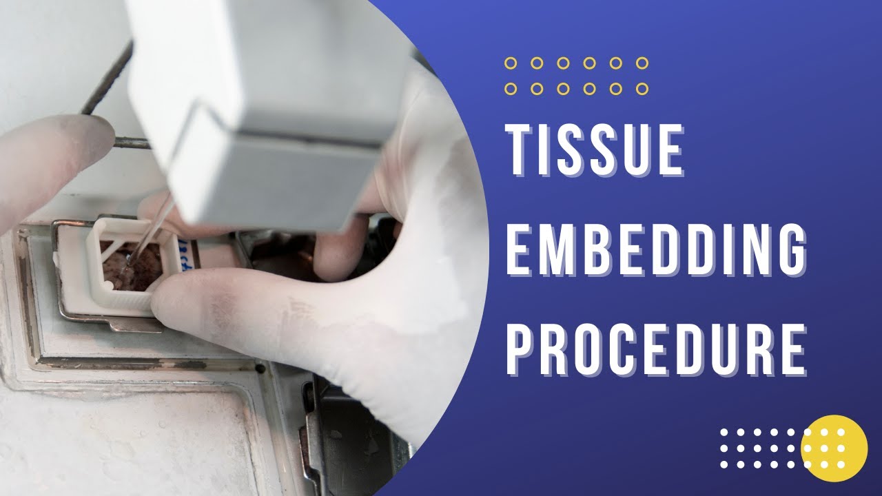 Histology Embedding process | Embedding technique (Histology)