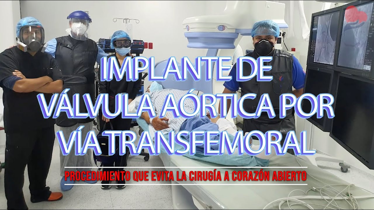 Implante de v&aacute;lvula a&oacute;rtica por v&iacute;a transfemoral