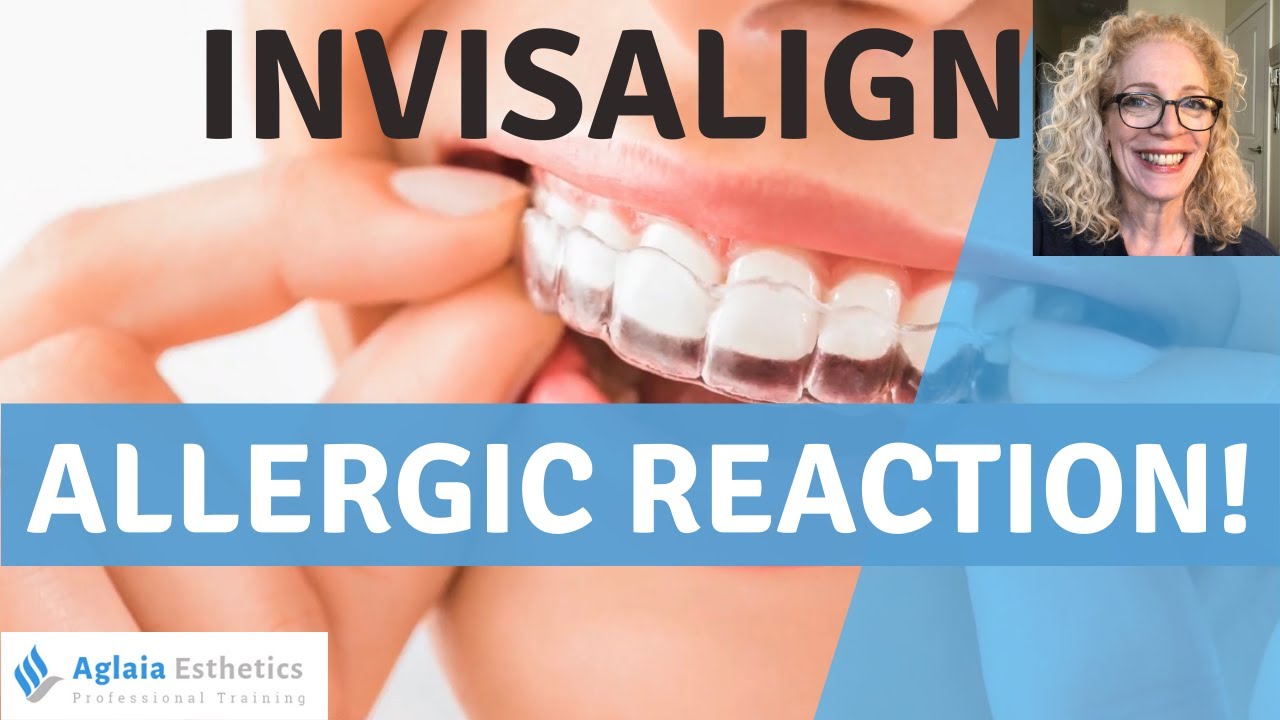 MY INVISALIGN ALLERGY STORY REVEALED!