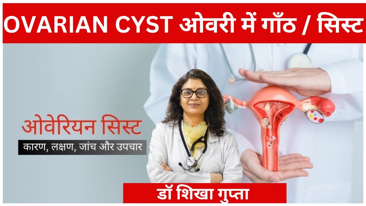 ओवरी सिस्ट कारण, लक्षण, निदान, बचाव और इलाज | Ovarian Cyst in Hindi | ओवरी में गाँठ / सिस्ट