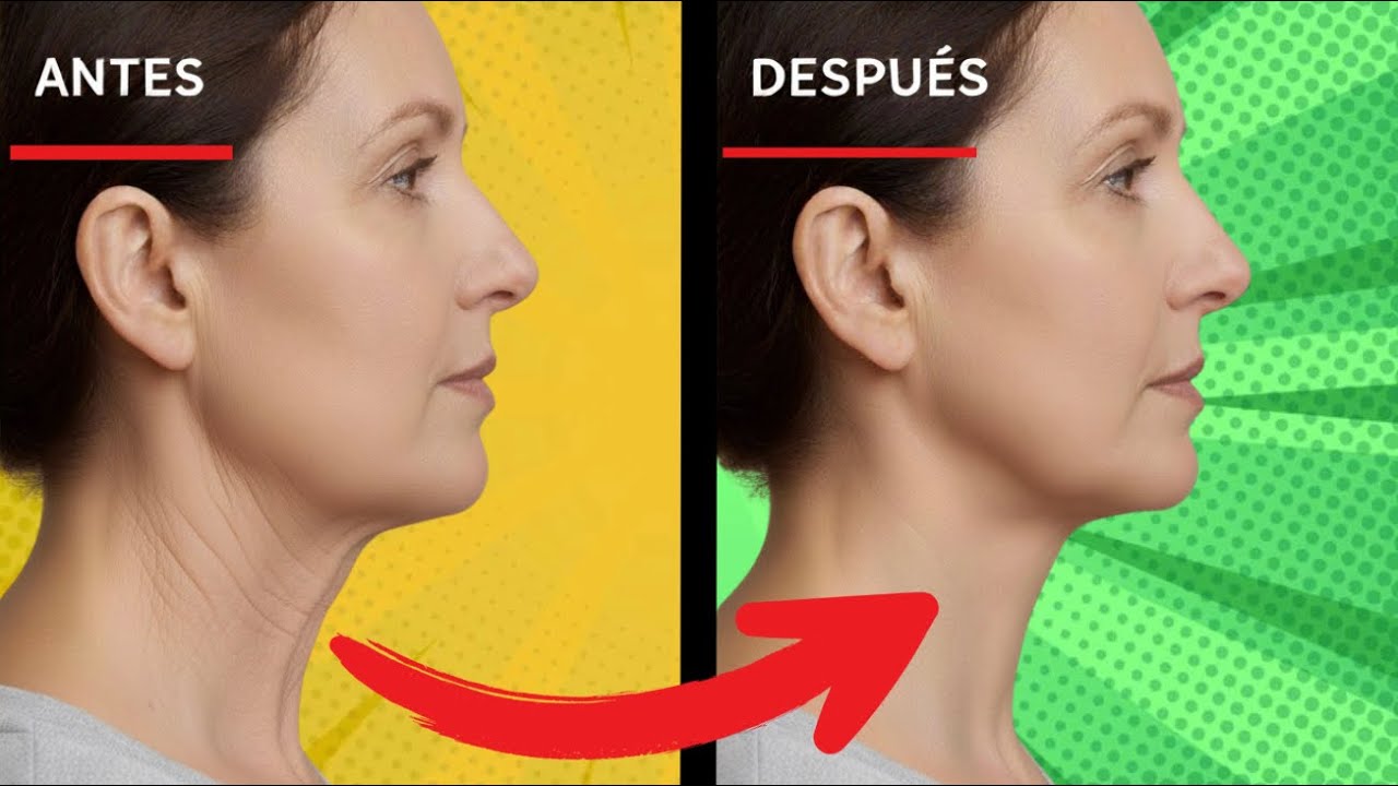 Qué NO avance la flacidez en el cuello