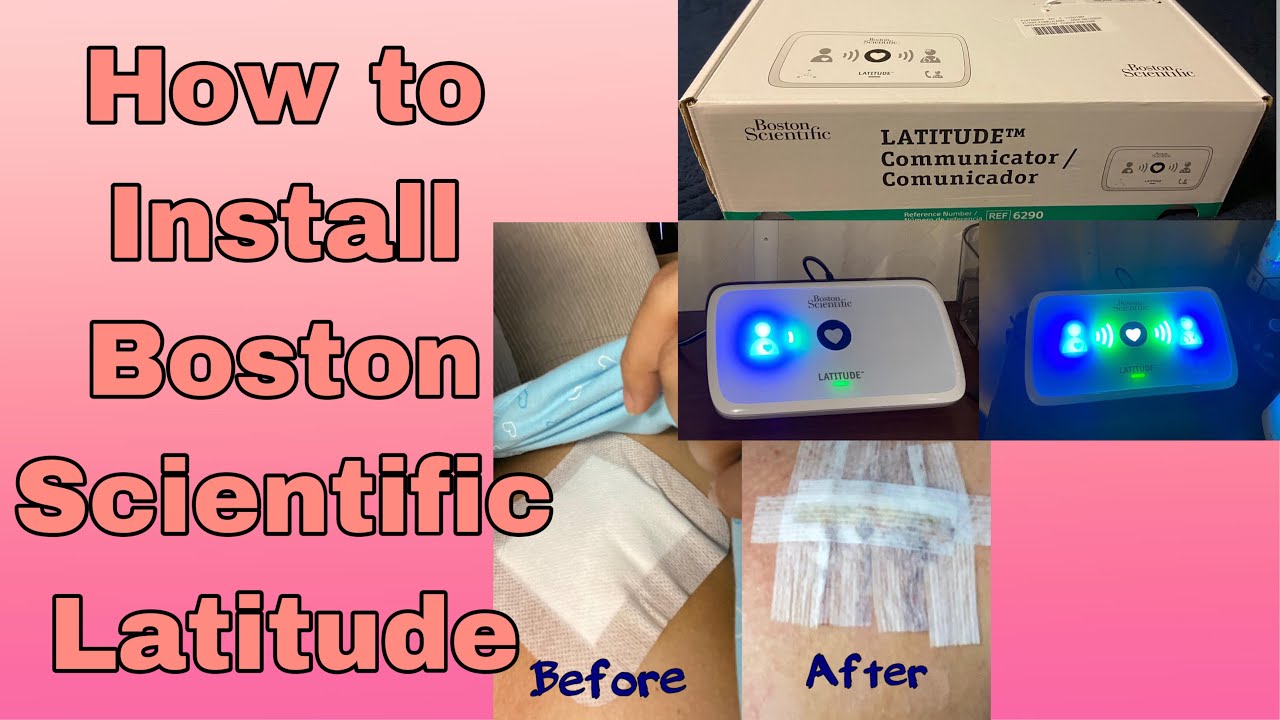 Как установить Boston Scientific Latitude Communicator | Установка нового кардиостимулятора | Рас...