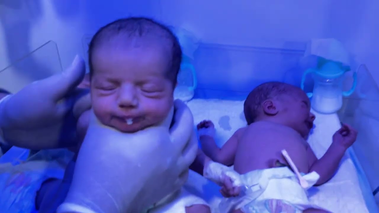Adorable Triplet Babies | Delivered Together, Stable & Starting Feeding#neonatologist #neonatalicu #