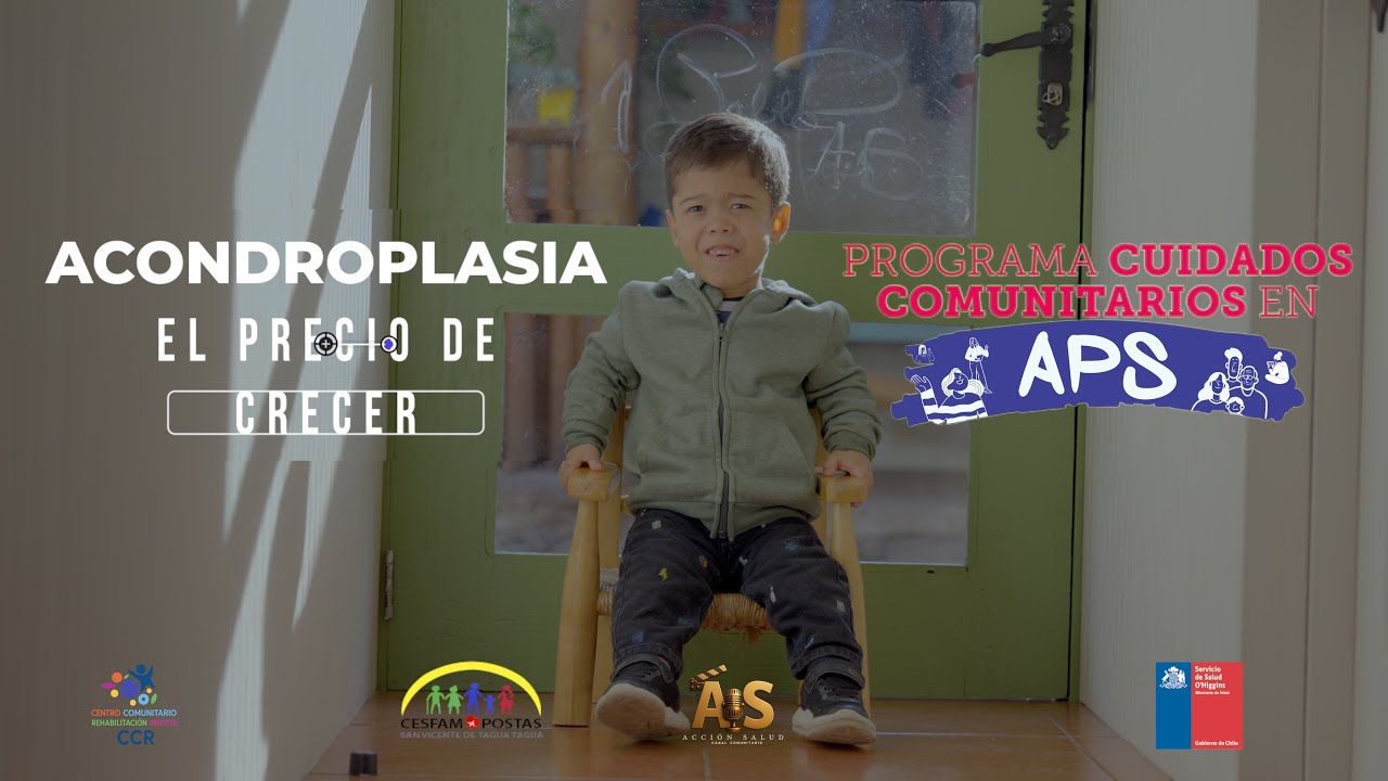 ACONDROPLASIA  
