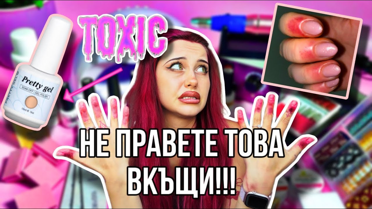 АЛЕРГИЧНА РЕАКЦИЯ КЪМ ГЕЛ ЛАК??? КАКВО СЕ СЛУЧИ?