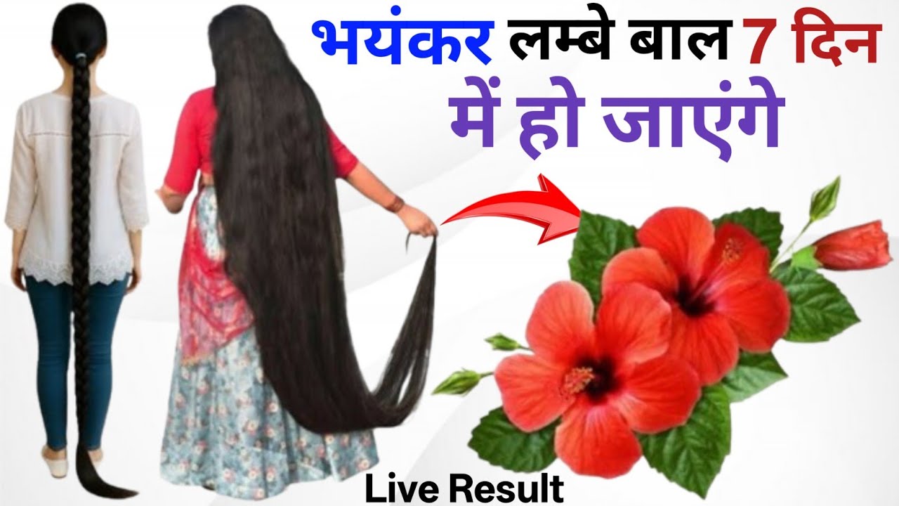 गुड़हल के पत्तों में एक चीज़ मिलाकर आप अपने बालों में लगा लो | Bal bhayankar Lambe Ghane Ho jaenge💯✅