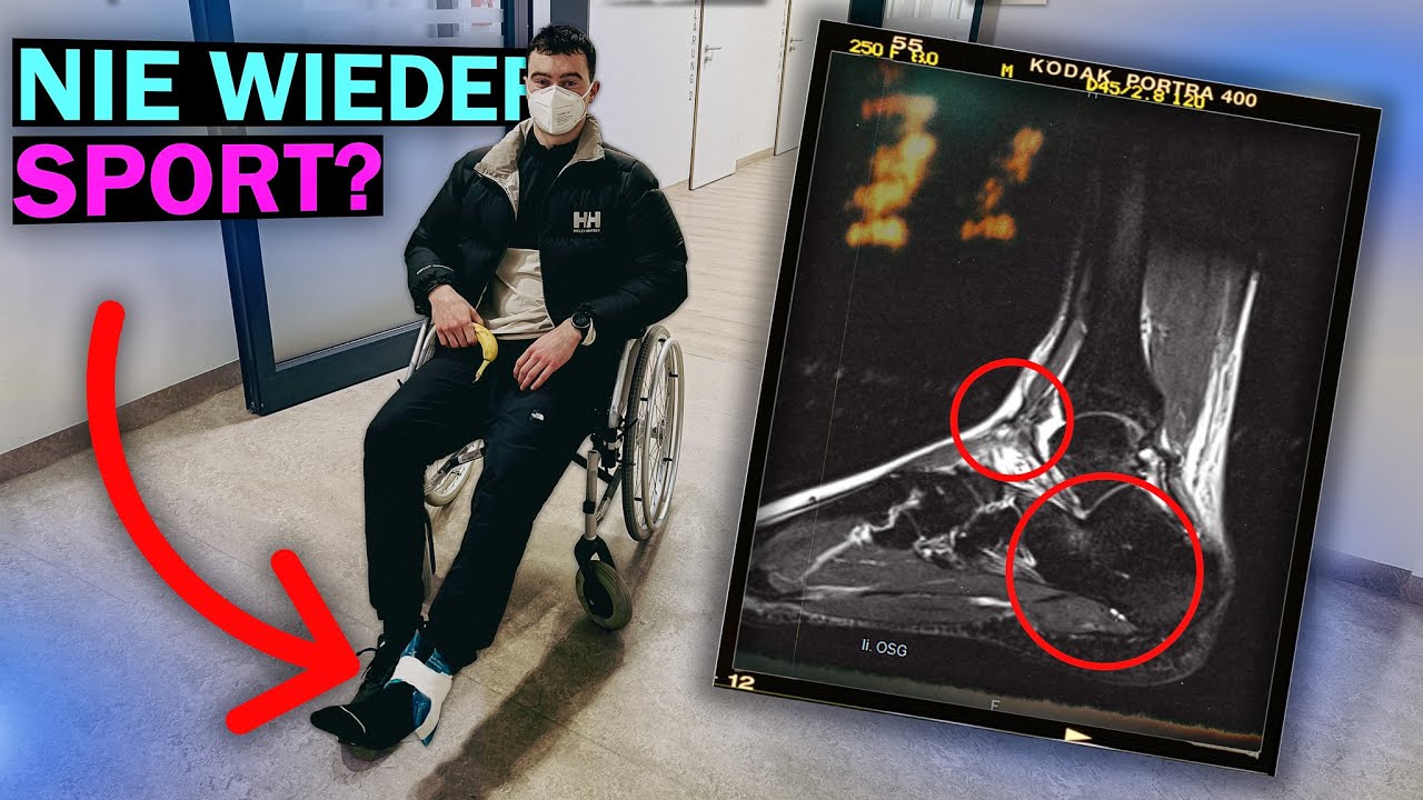 Ich habe mich Verletzt! (Bänderriss) | Update VLOG