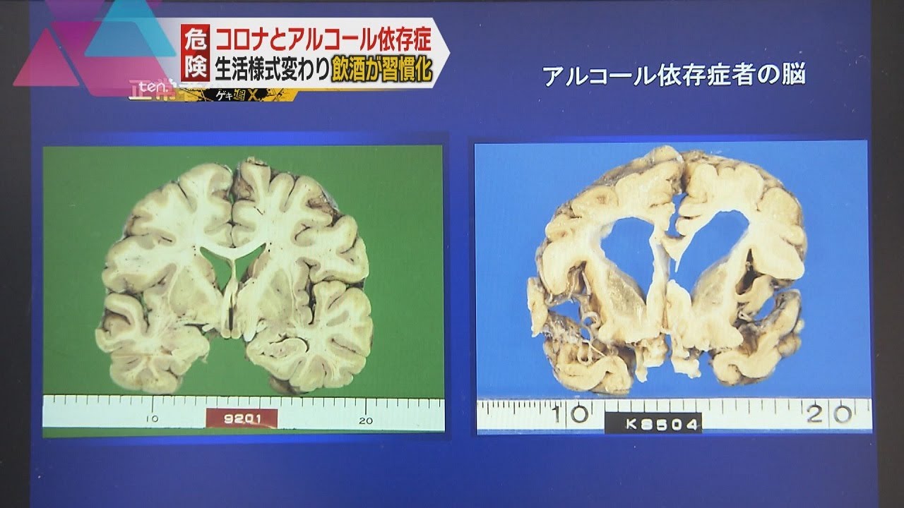 【ゲキツイX】コロナ自粛で要警戒「アルコール依存症」の危険