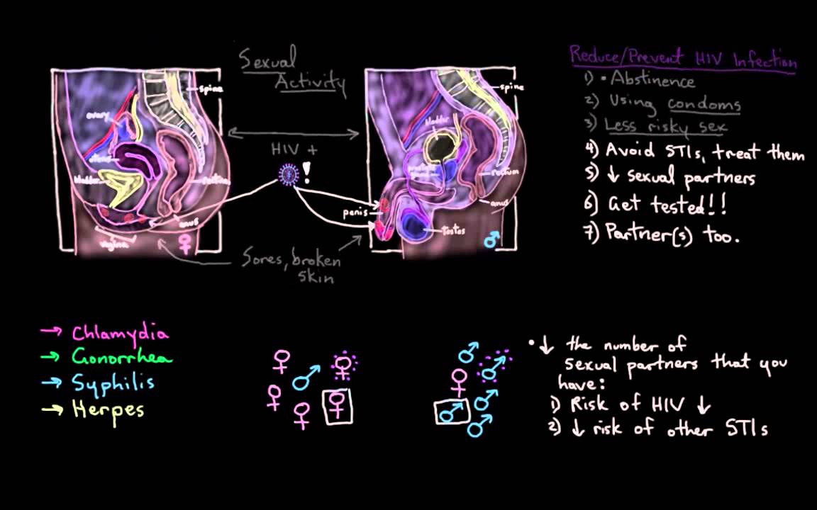 Khan Academy - Preventing an HIV Infection