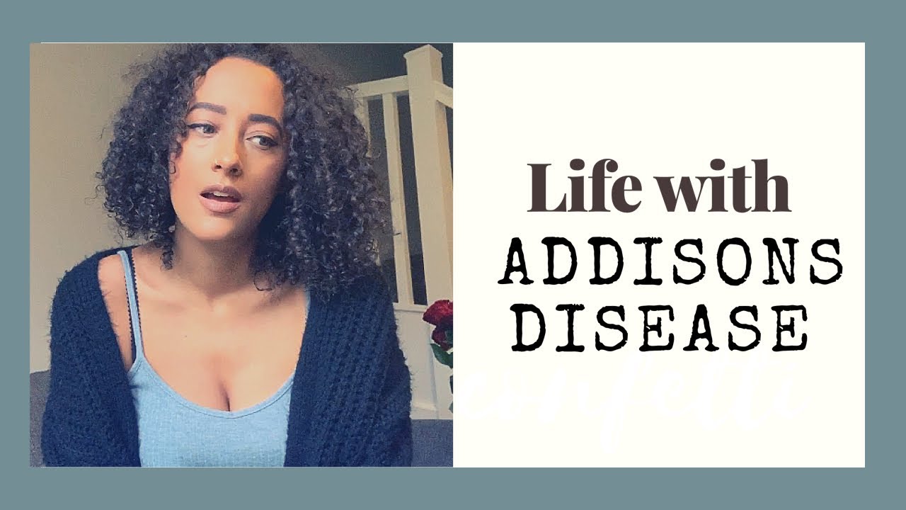 Life With Addison’s Disease | My Experience