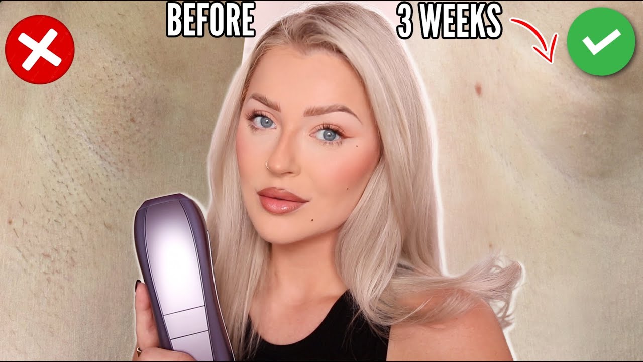 Dos & Don'ts of At Home Laser Hair Removal