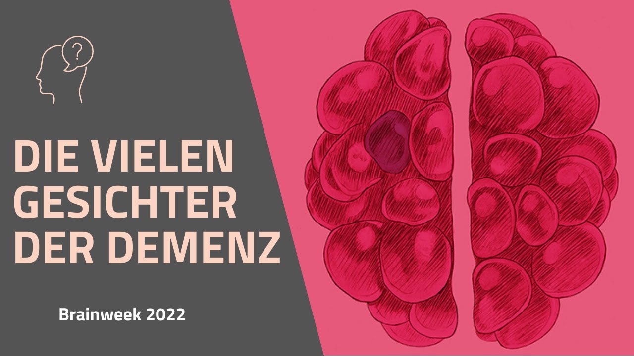 Die vielen Gesichter der Demenz
