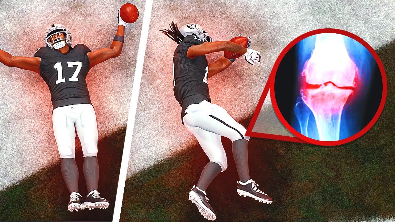 Madden 24 Raiders Franchise! Ambulance On The Field.. EP4