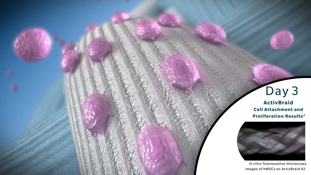 Zimmer Biomet ActivBraid Suture System | 3D Orthopedic Animation by Pulse 3D Media
