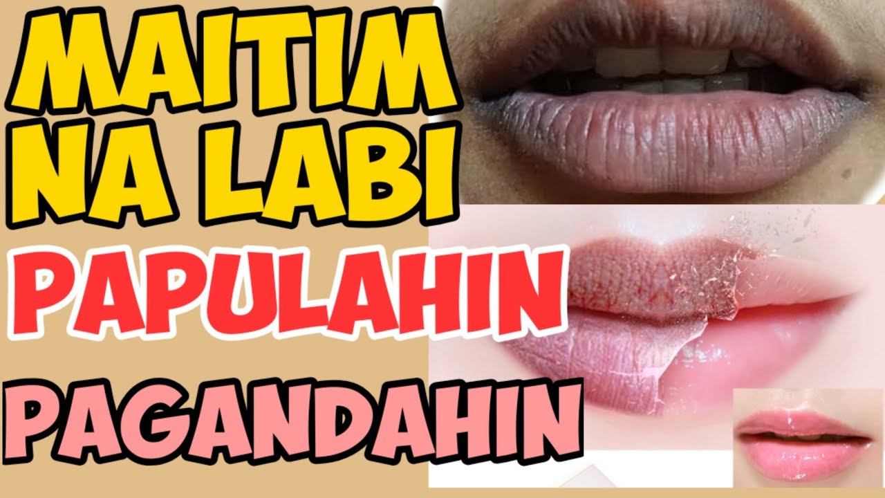 Maitim ang Labi : Paano Papulahin at Pagandahin - Payo ni Doc Liza Ramoso-Ong