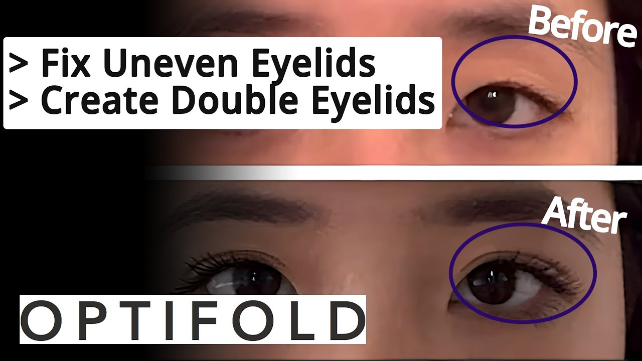 Optifold Eyelid Tapes Fix Uneven Eyelids Create Double Eyelids Without Surgery