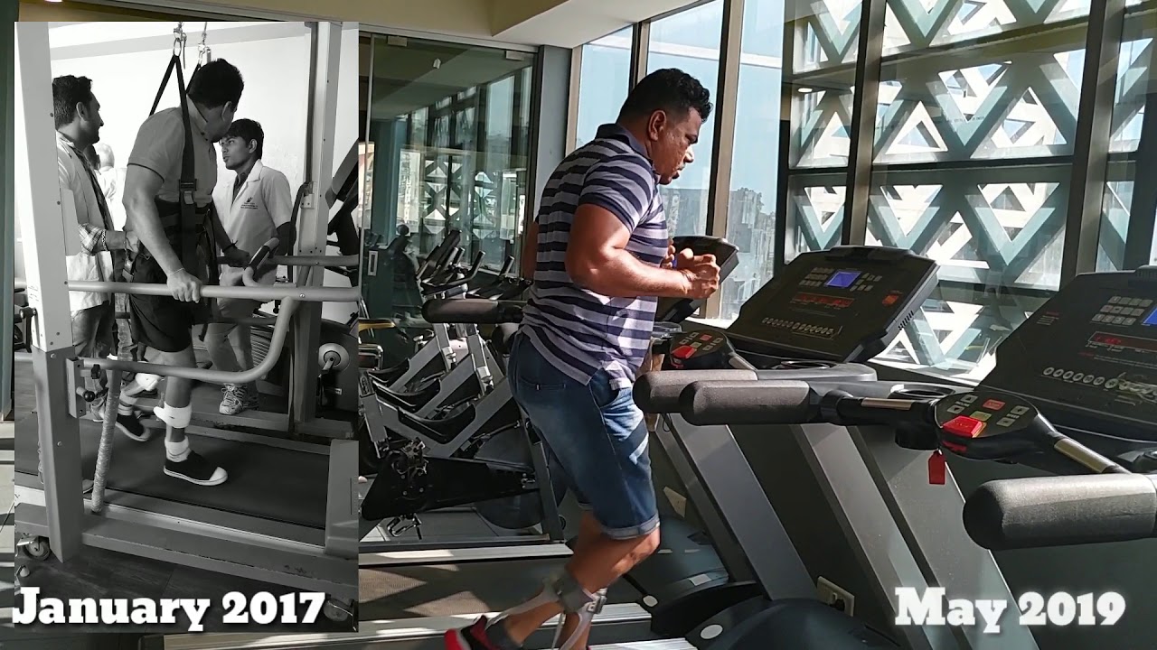 How I am improving my walking through exercises in Spinal Cord Injury.