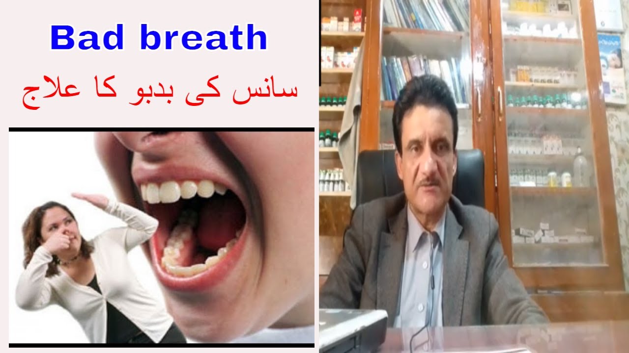 Bad breath homeopathic medicine  by Dr Asad Naqvi