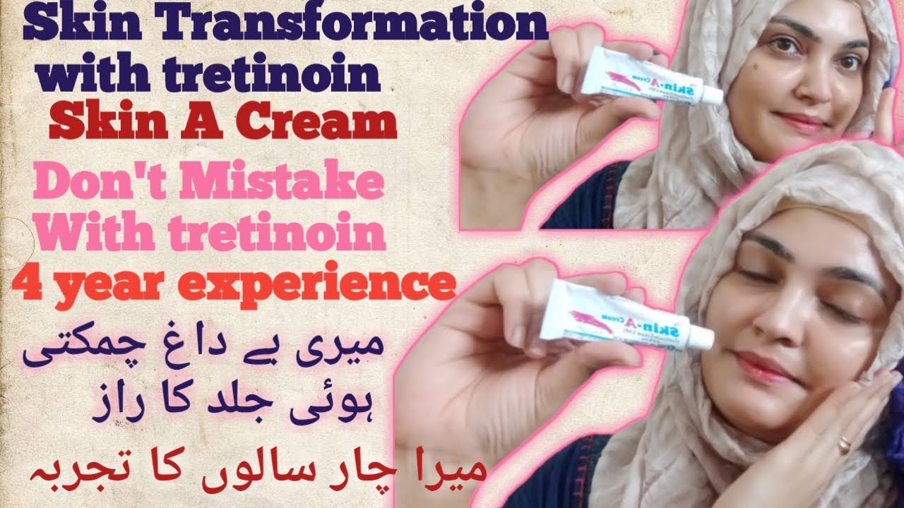 How To Apply Tretinoin SkinA Retinoid Cream| My Skin Transformation With Tretinoin SkinA Retinoid