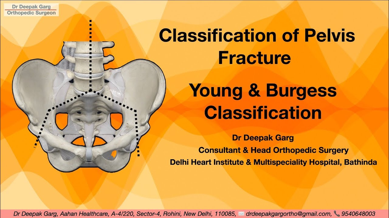 Understanding Pelvic Fracture Classification: Young and Burgess System Explained | Dr Deepak Garg