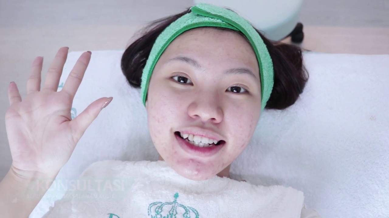 Bye Bye Jerawat Nakal - Vlog Veronica Ong