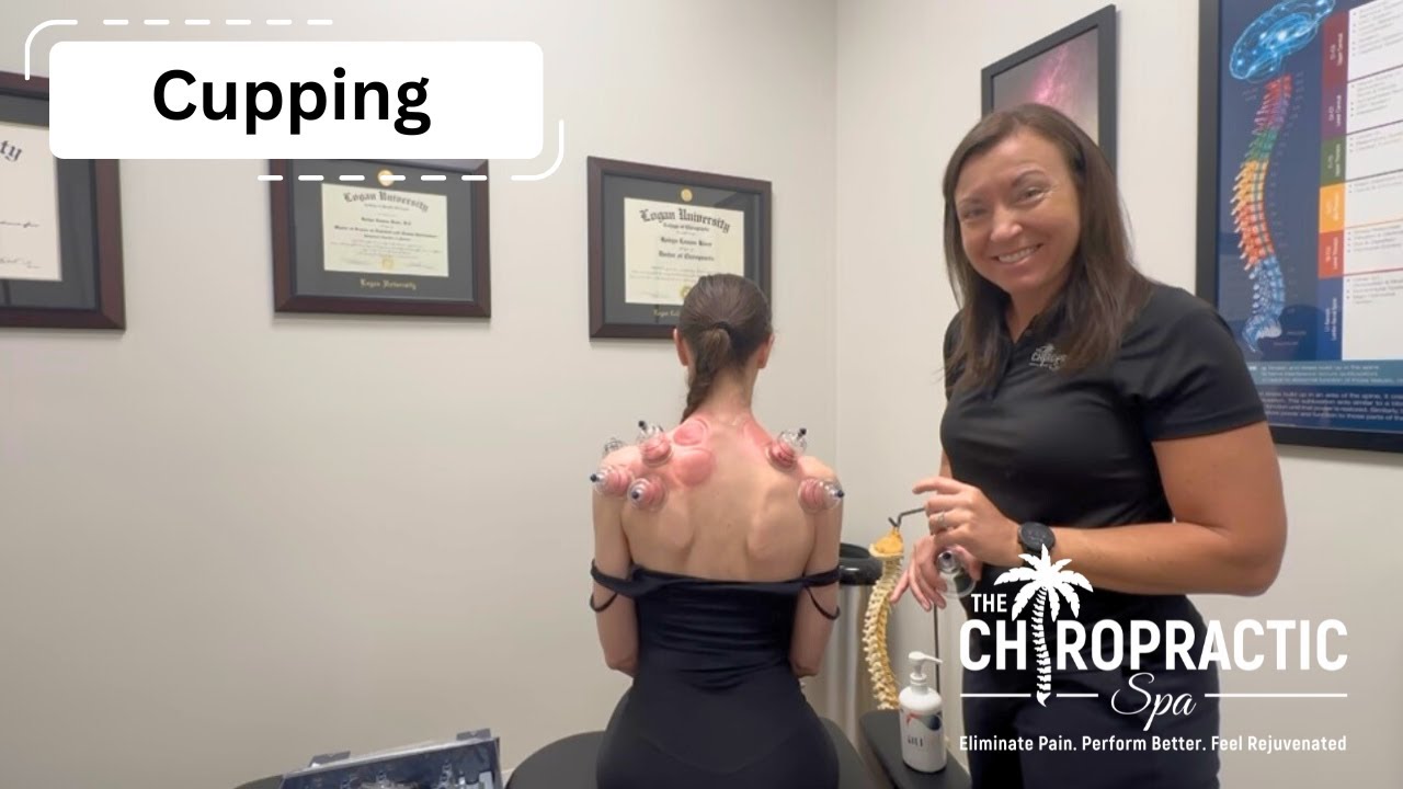Cupping with Dr. Robyn