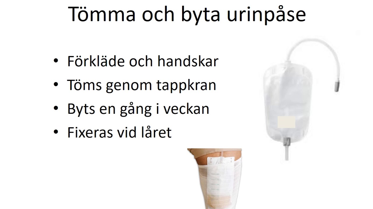 Video  Kvarliggande urinkateter modul 8
