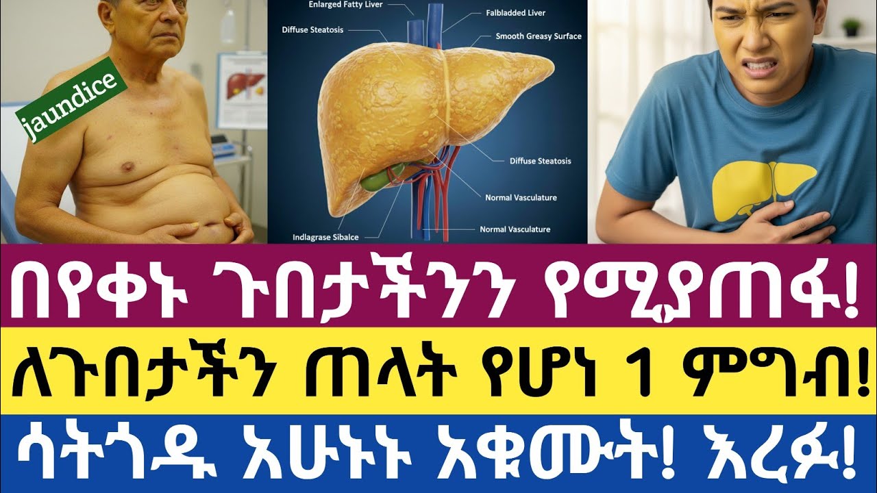 በየቀኑ ጉበታችንን የሚያጠፋ አንድ መጥፎ ምግብ - የተጨመረ ስኳር | One Food That Destroys Your Liver Daily: ADDED SUGAR