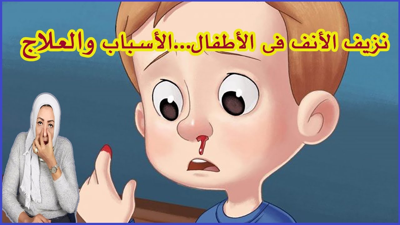 نزيف الأنف في الأطفال..الأسباب والعلاج #الرعاف #nosebleeds #epistaxis