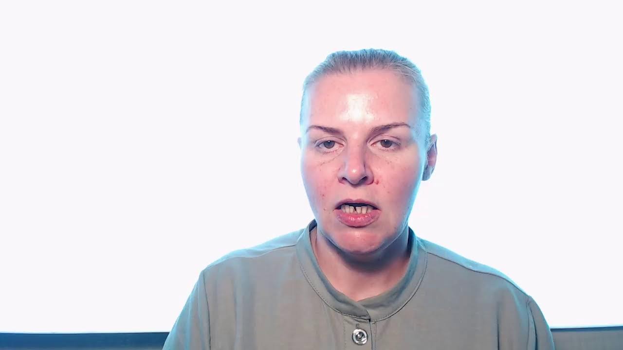 Тычинки пушистого одуванчика.