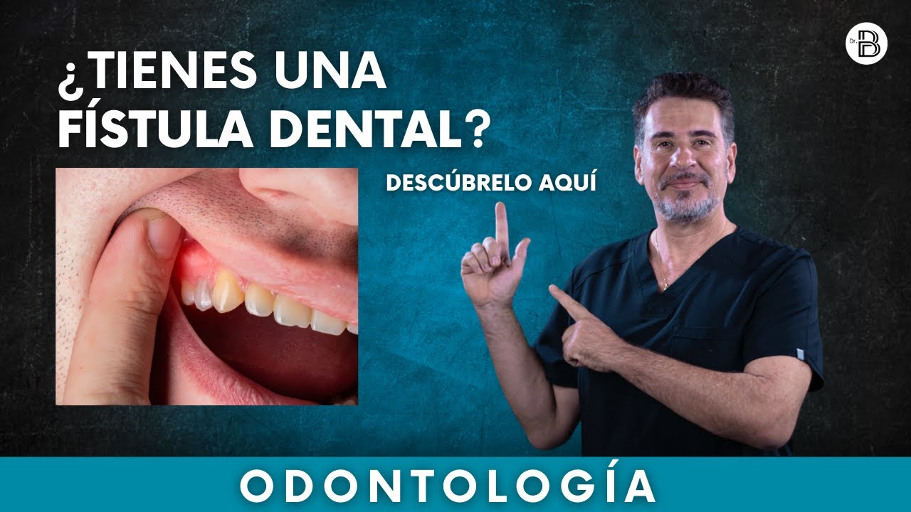 FÍSTULA DENTAL ¿Qué es y cómo eliminarla?👈