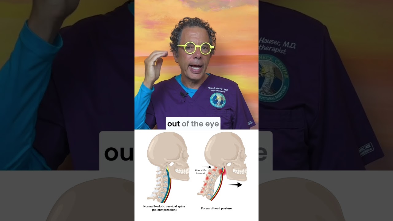 Double eye squish can cause blurry vision, glaucoma, visual snow, high eye pressure & more symptoms