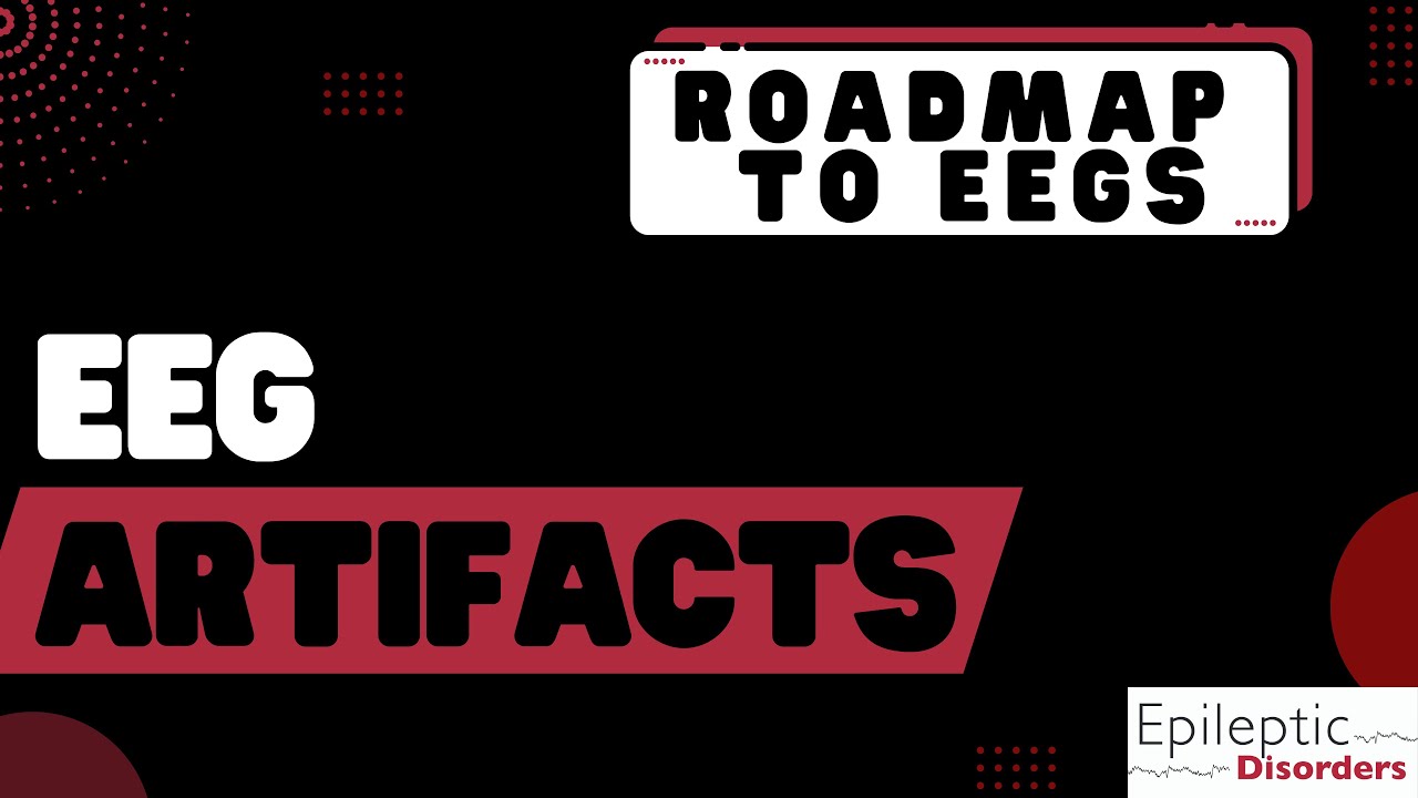 Roadmap to EEGs: EEG Artifacts