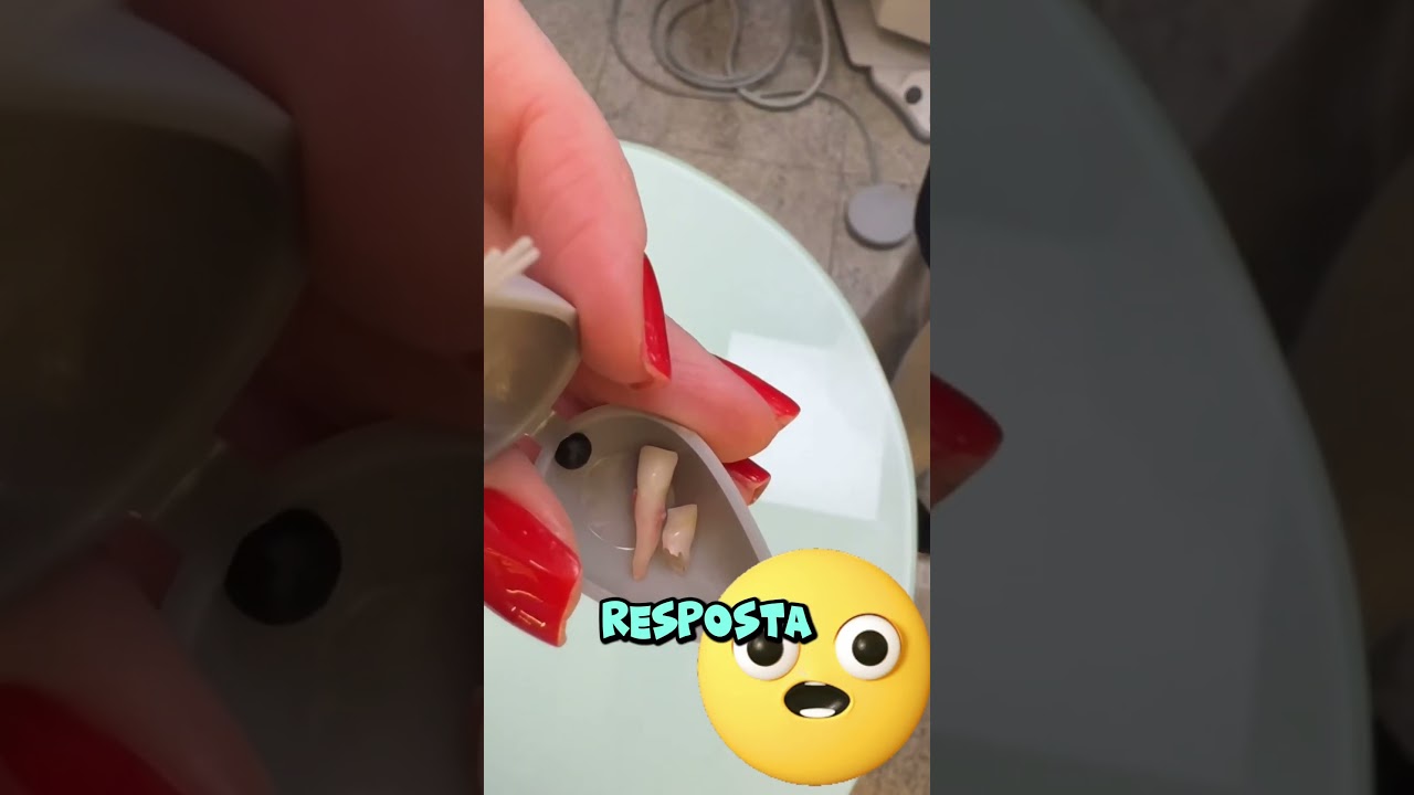 Dente de leite tem raiz?