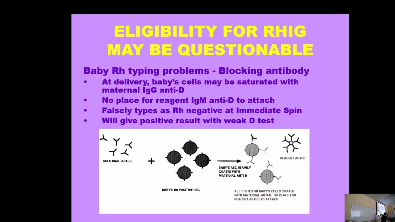 BB Lecture 16 RhIg