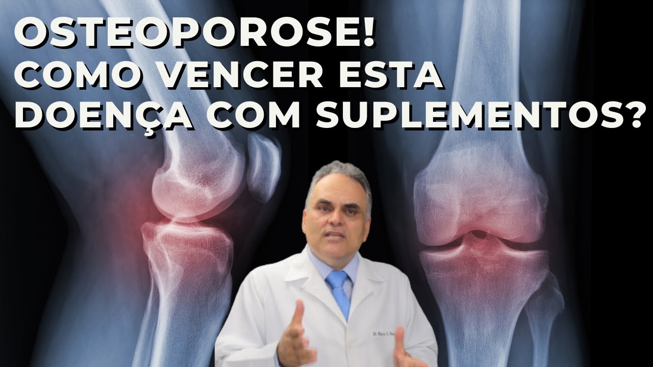 Como vencer a osteoporose? Dicas de suplementos e vitaminas!
