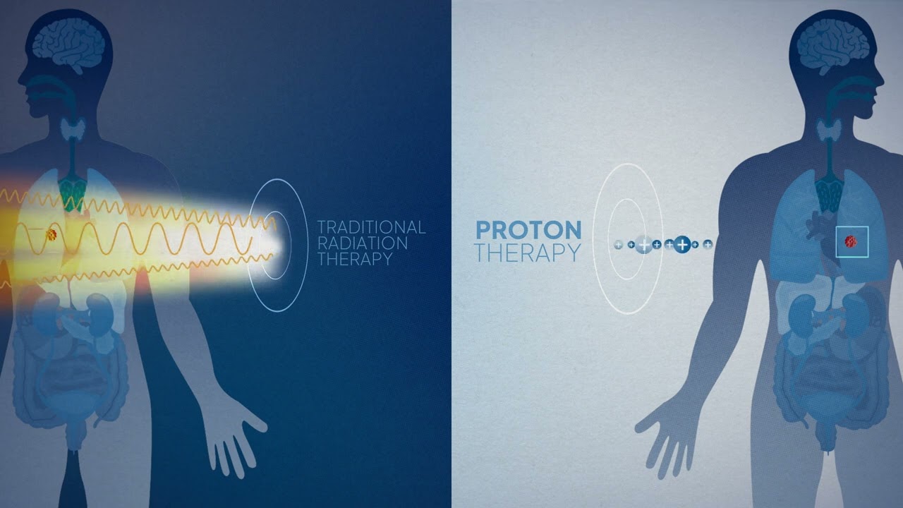 What is Proton Therapy and How Does it Work? Penn Medicine Explains